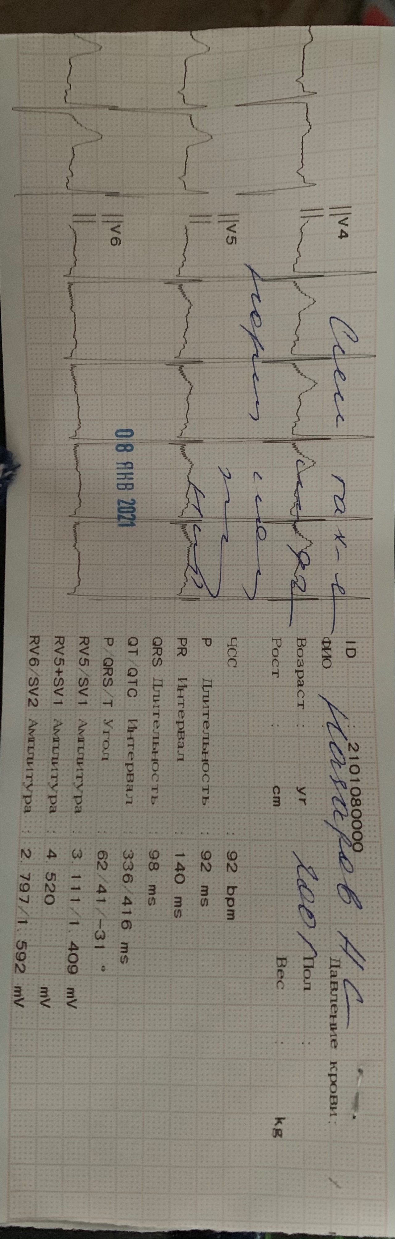 Расшифровать экг онлайн по фото бесплатно и без регистрации