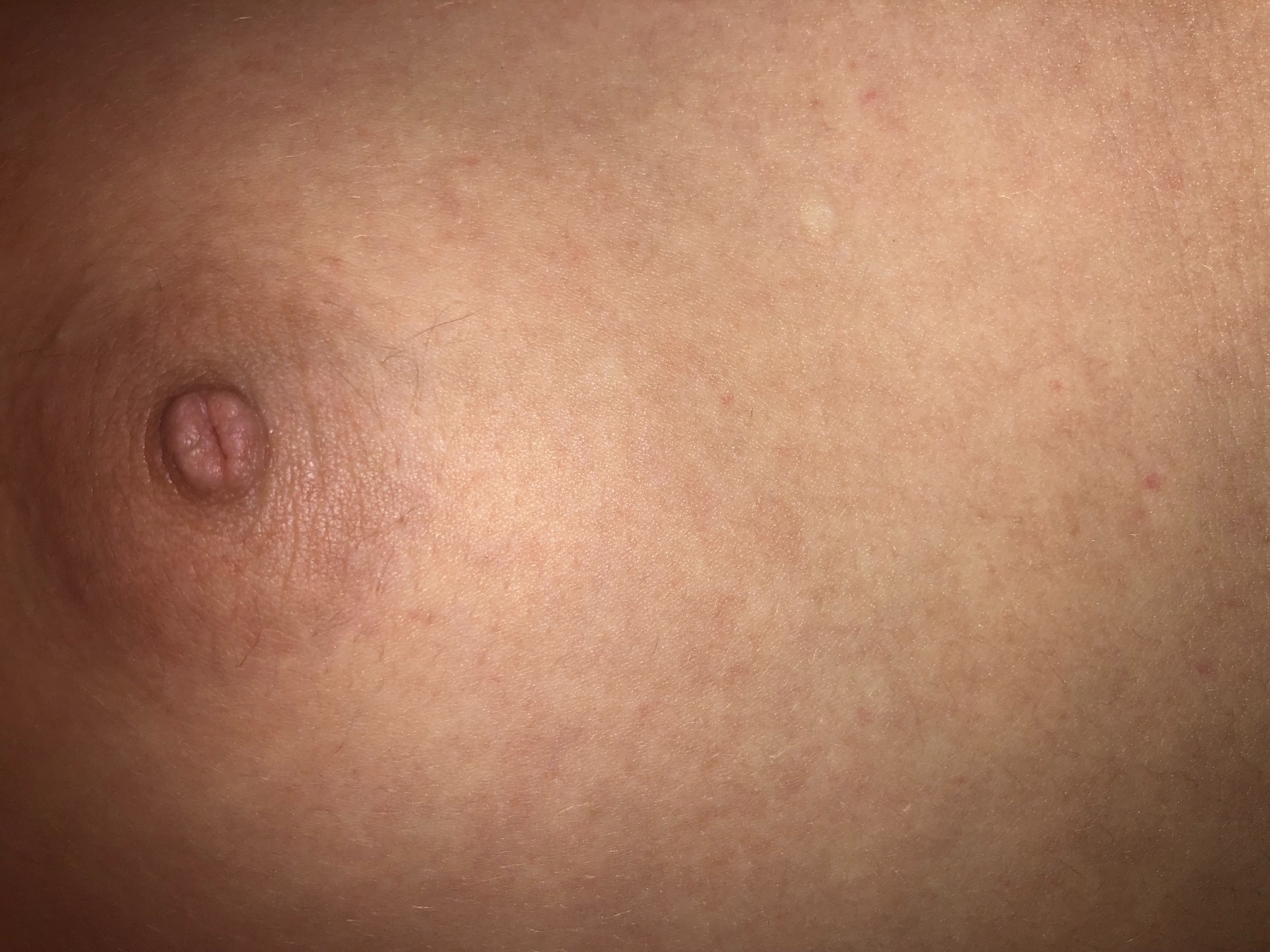 уплотнения на груди при беременности фото 11