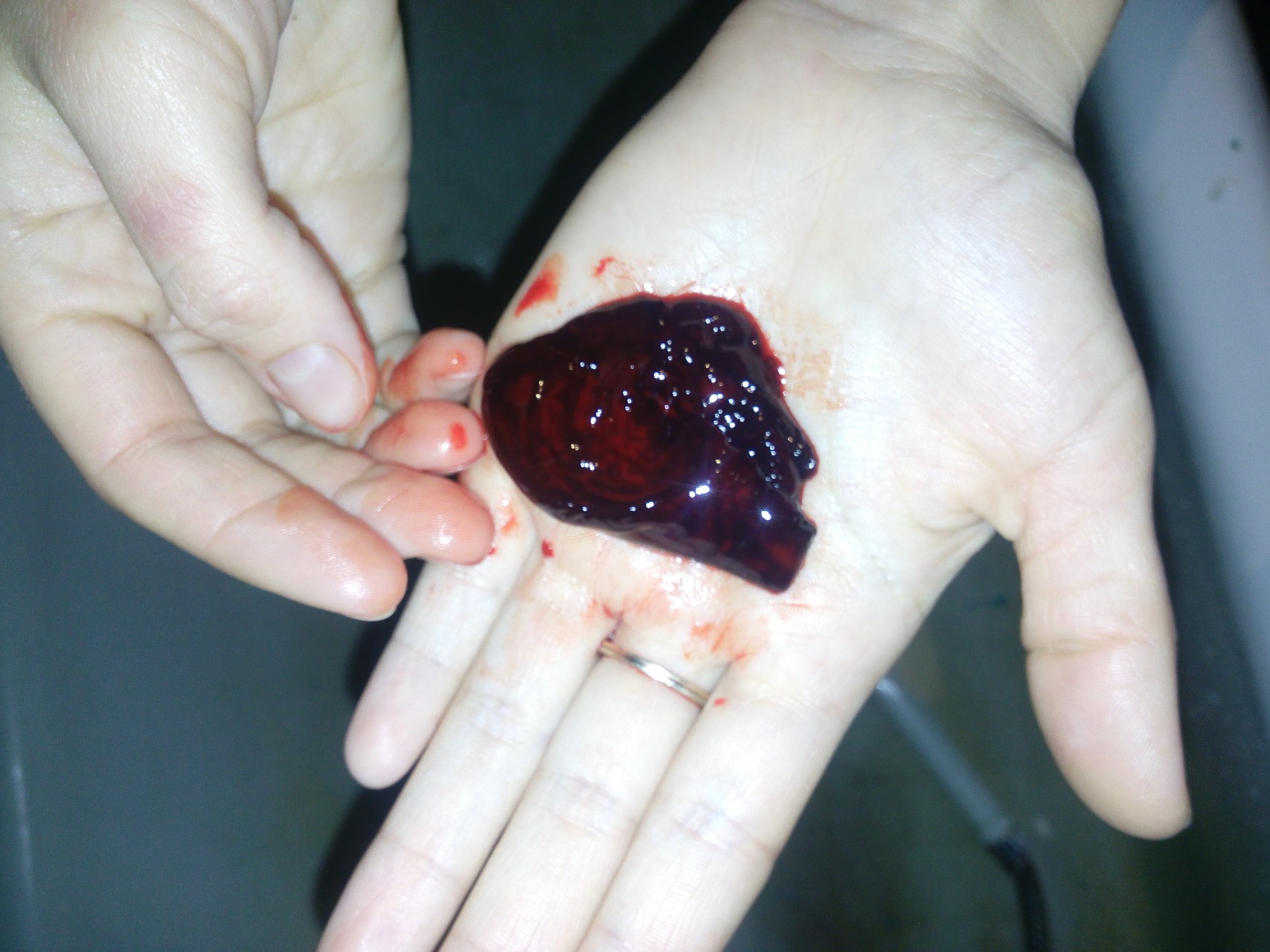 кровь из члена один сгусток фото 43