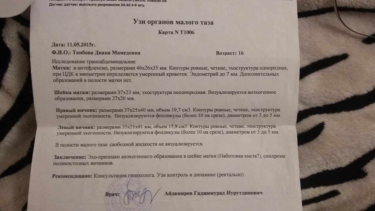 Когда делают узи малого таза после месячных