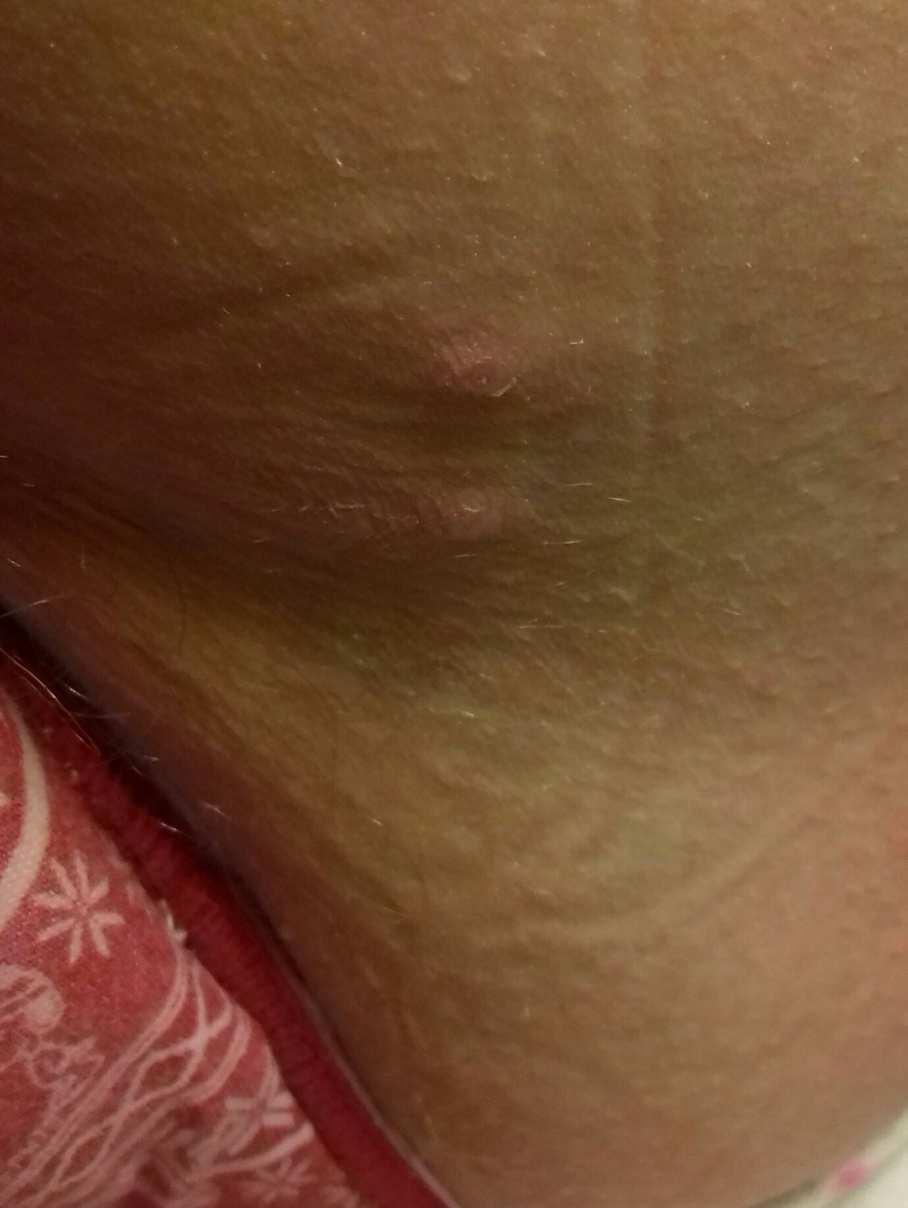 сифилисом можно заразится от мастурбации фото 98