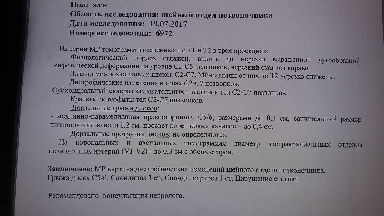 Операции грыжи шейного отдела позвоночника отзывы