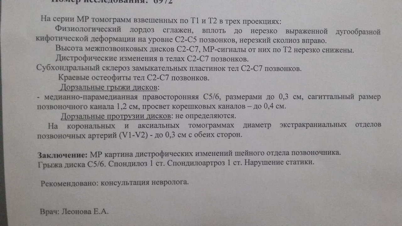 Мрт результаты сразу. Как выглядят Результаты мрт. Результаты мрт головного мозга расшифровка фото и обозначения.