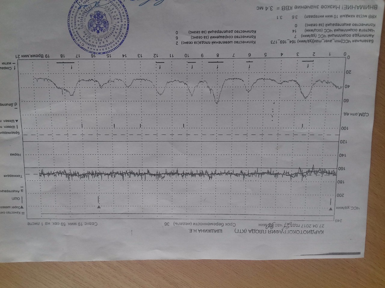 Ктг расшифровка фото