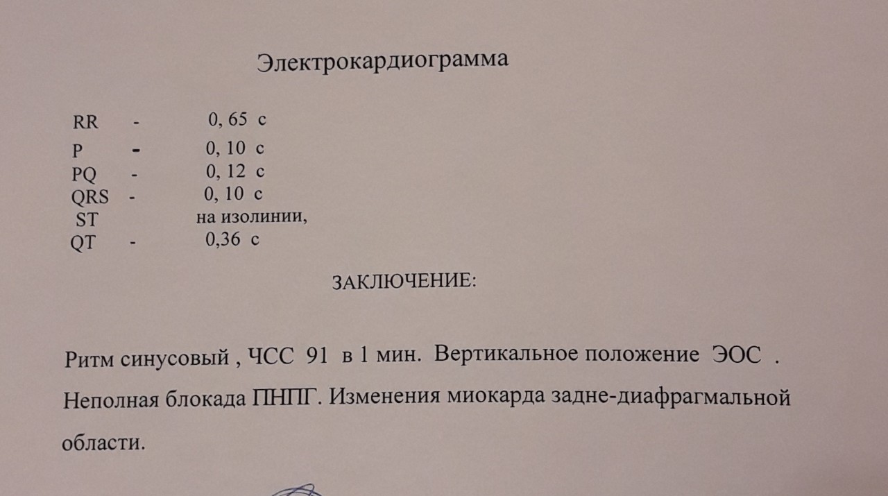 Заключение экг. Что означает заключение ЭКГ-состояние миокарда.