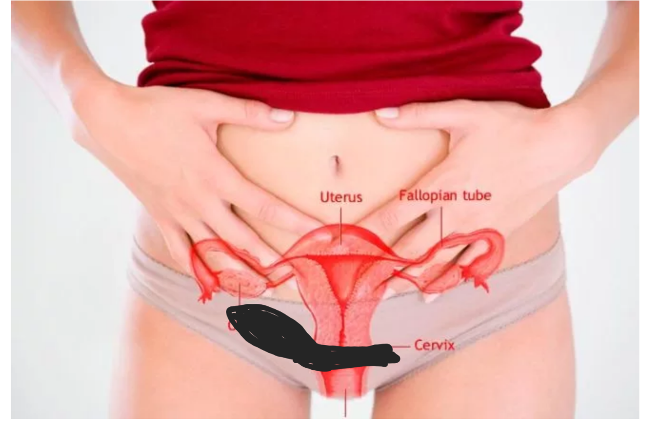 Яичники у женщин расположение. Расположение яичников у женщин. Где находятся яичники у женщины. Расположение матки и яичников.