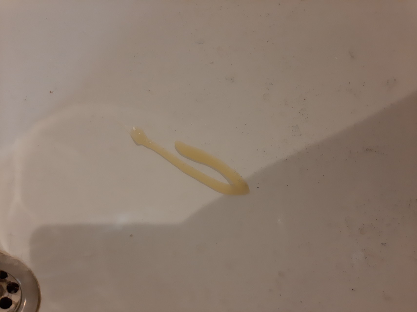 твердые желтые комочки в сперме фото 36