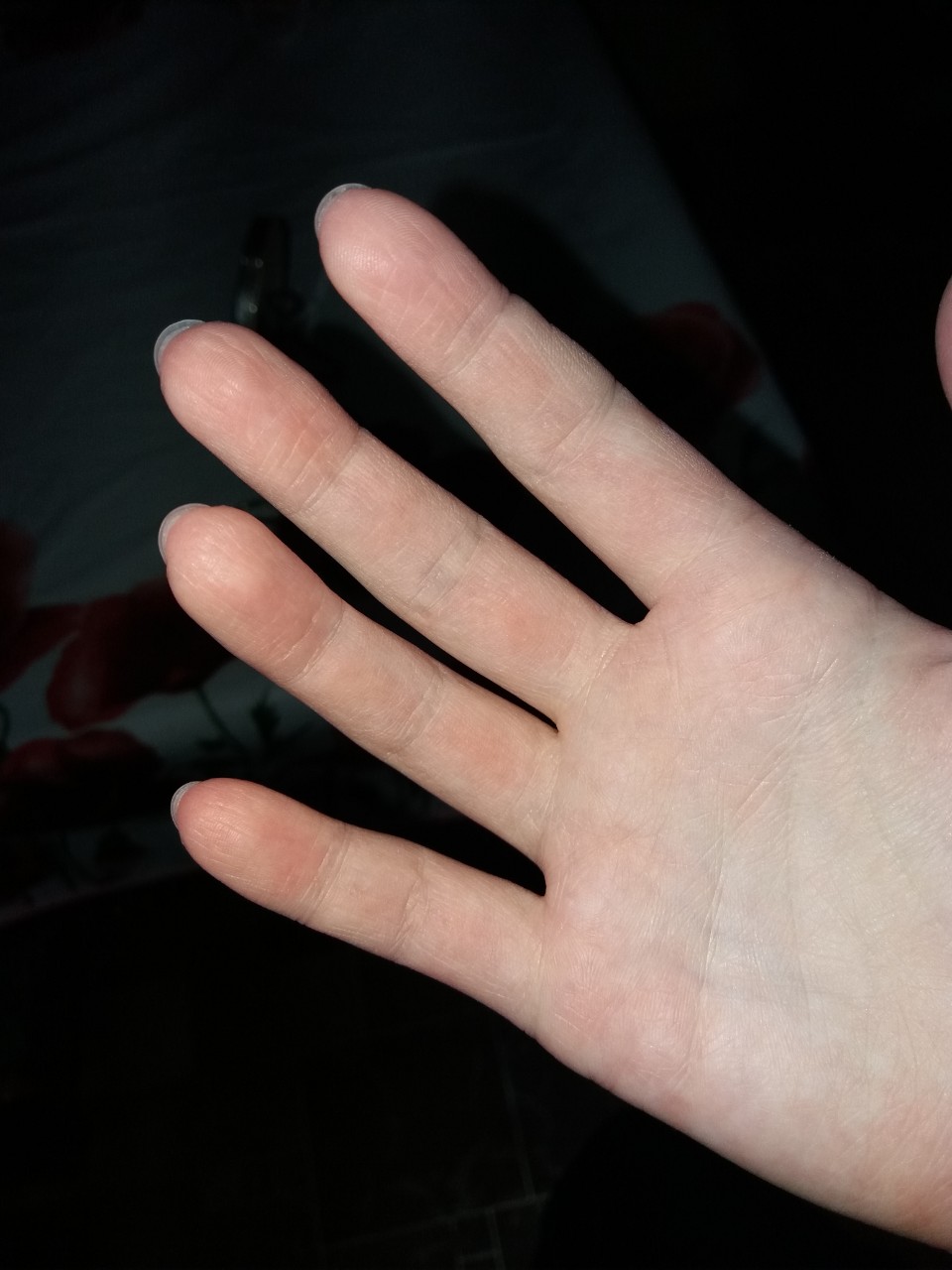 Красные точки между пальцами рук