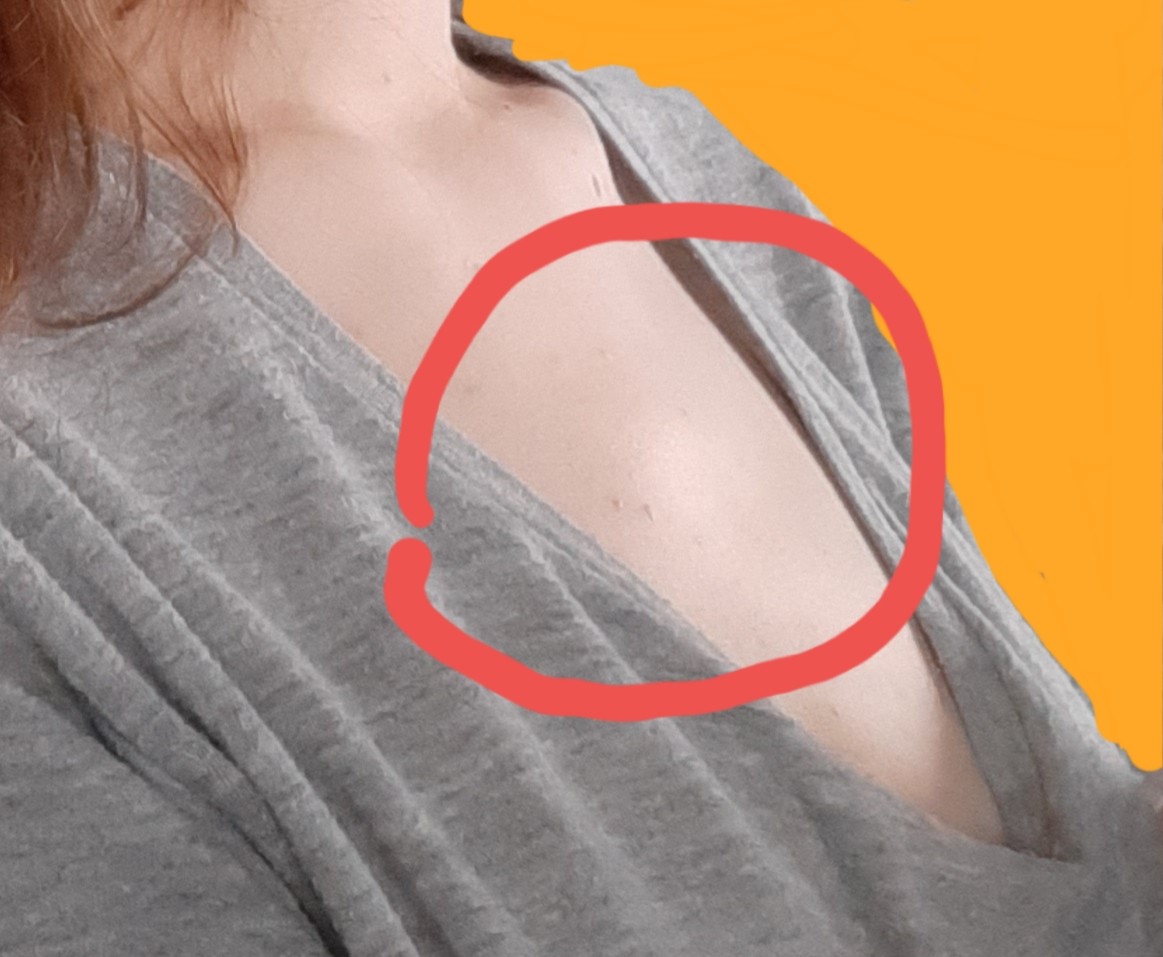 вены на груди это признак беременности фото 88