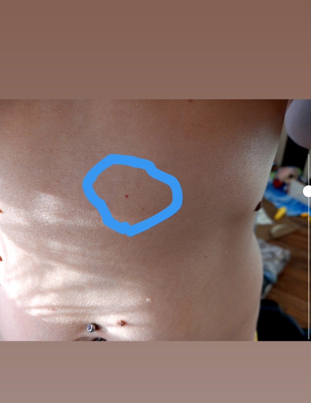 черные точки на груди у женщин фото 108