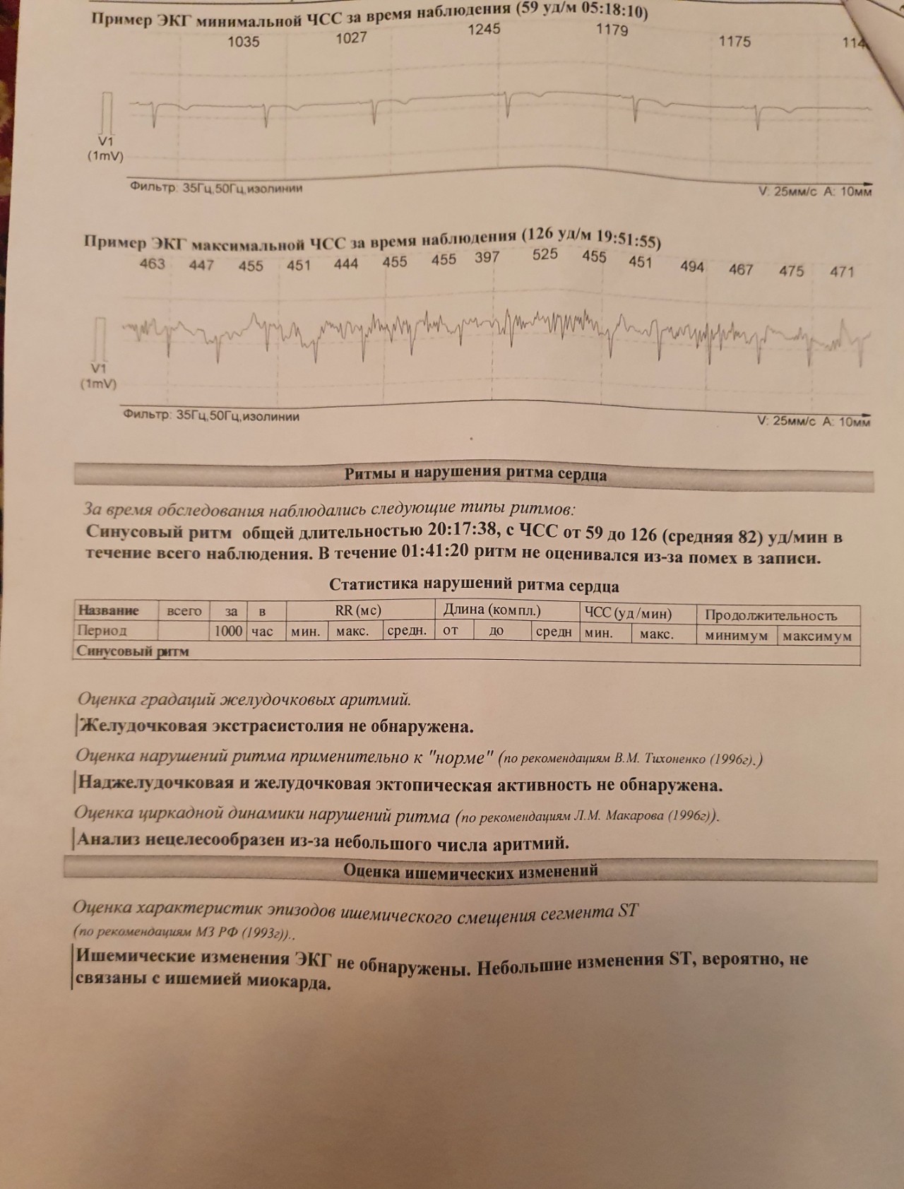 Циркадный индекс чсс снижен. Усиленный циркадный профиль ритма это. Кардионевроз на ЭКГ. Циркадный индекс снижен. Циркадный код книга.