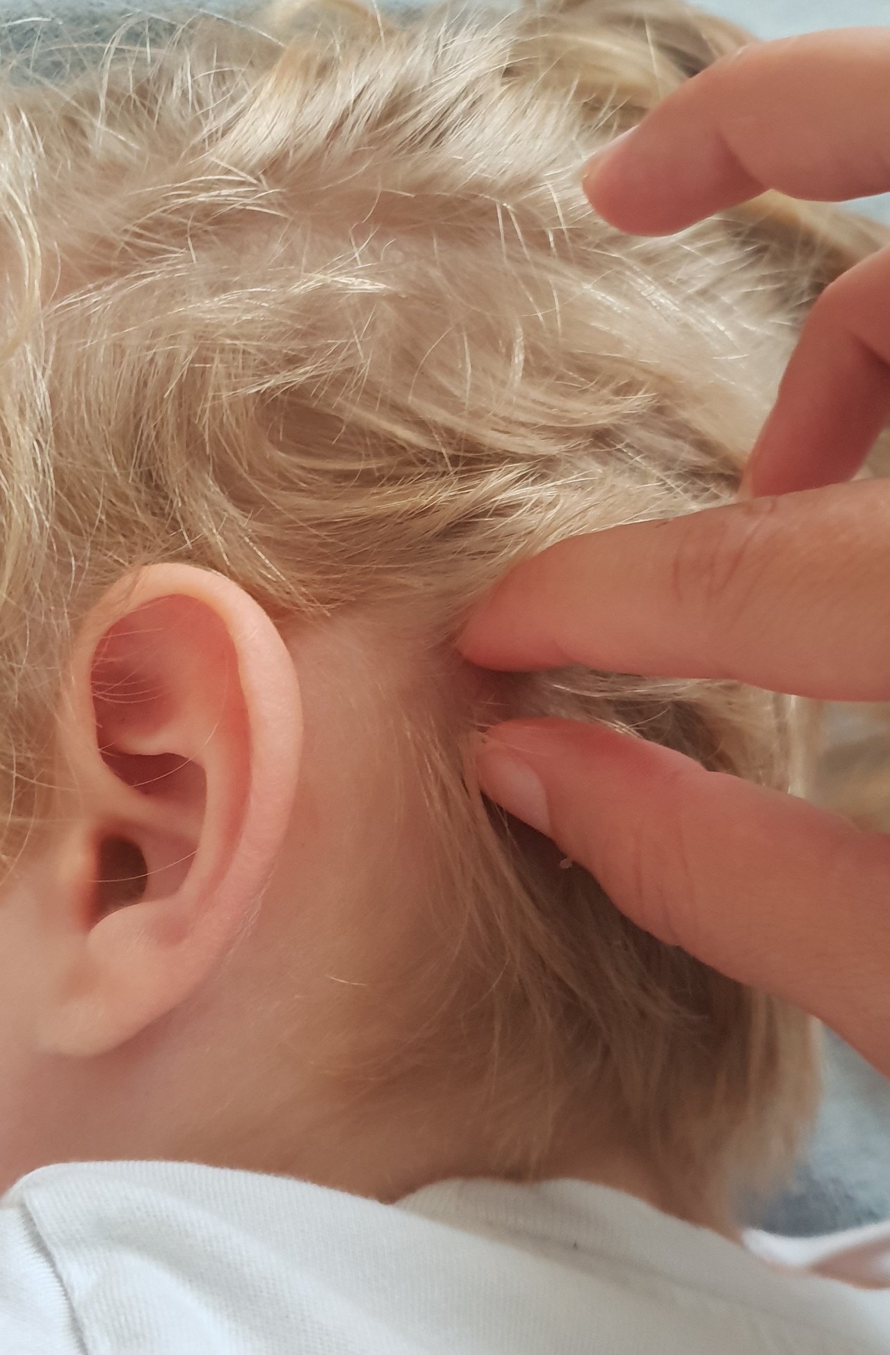 Шишки на голове за ухом у ребенка