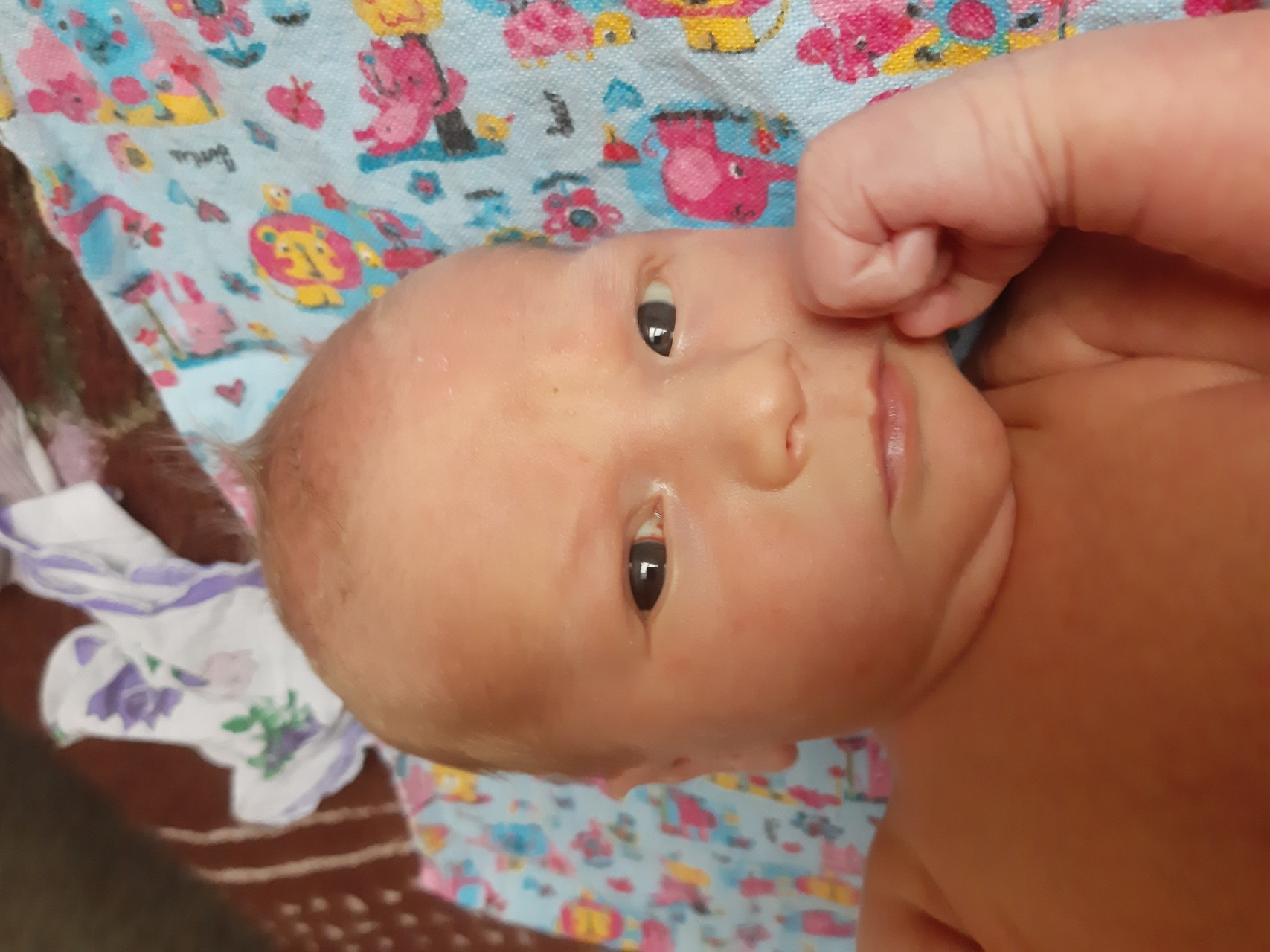 Белки глаз новорожденного. Желтые белки у новорожденных. У младенца желтые белки глаз. Белки глаз у новорожденного. Желтушка у новорожденных желтые белки глаз.