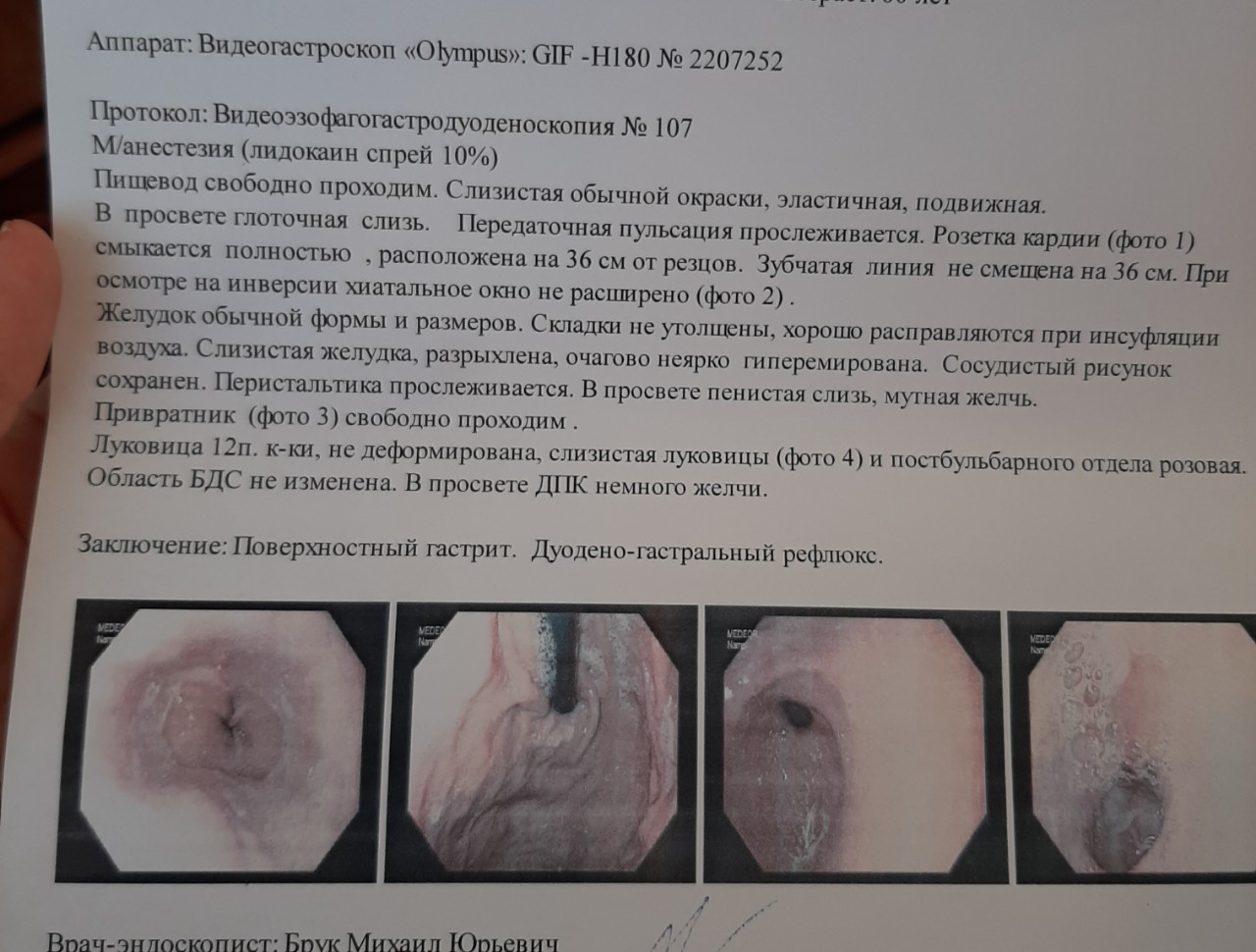 болит желудок после минета фото 37