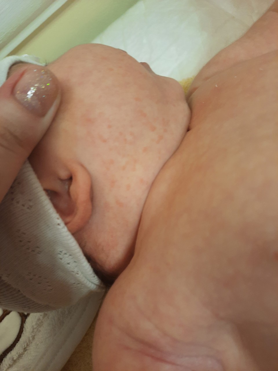 у новорожденного припухла одна грудь фото 25