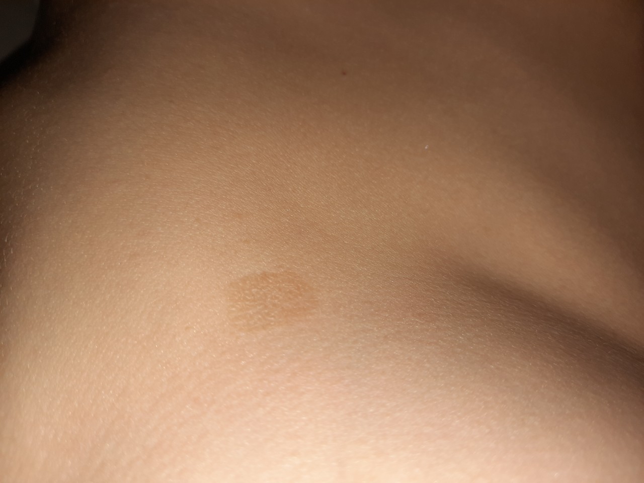 коричневые пятна на груди беременность фото 22