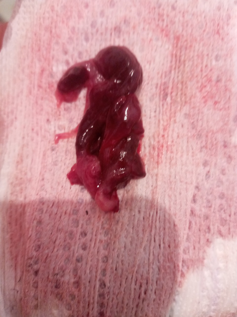 кровяные сгустки в сперме у мужчин фото 47