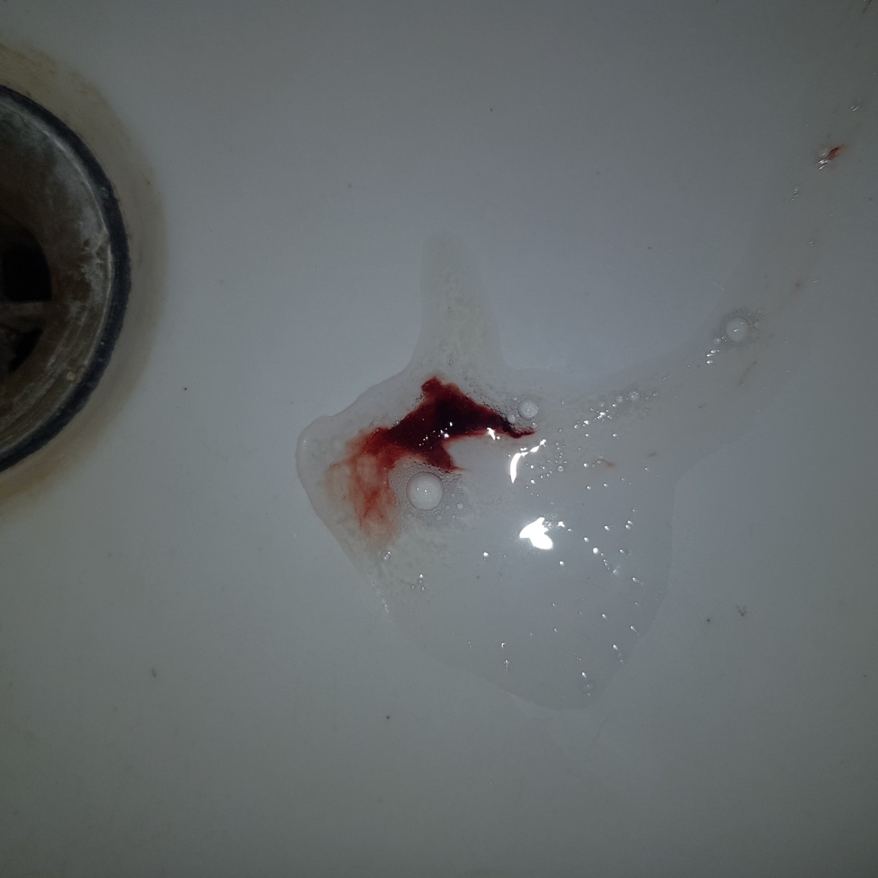 кровь из члена один сгусток фото 8