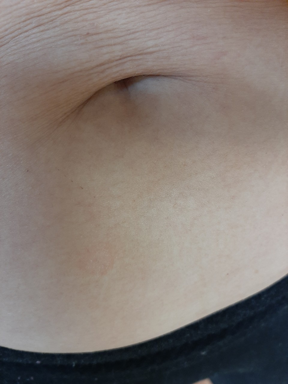 шелушится кожа на груди во время беременности фото 81