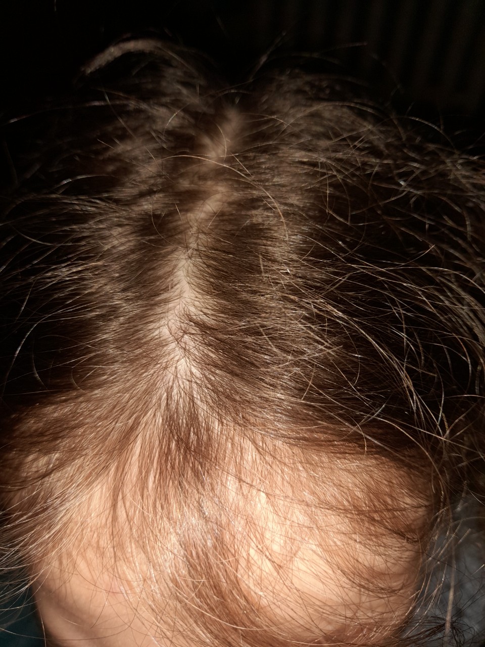Болезни и аномалии стержней волос