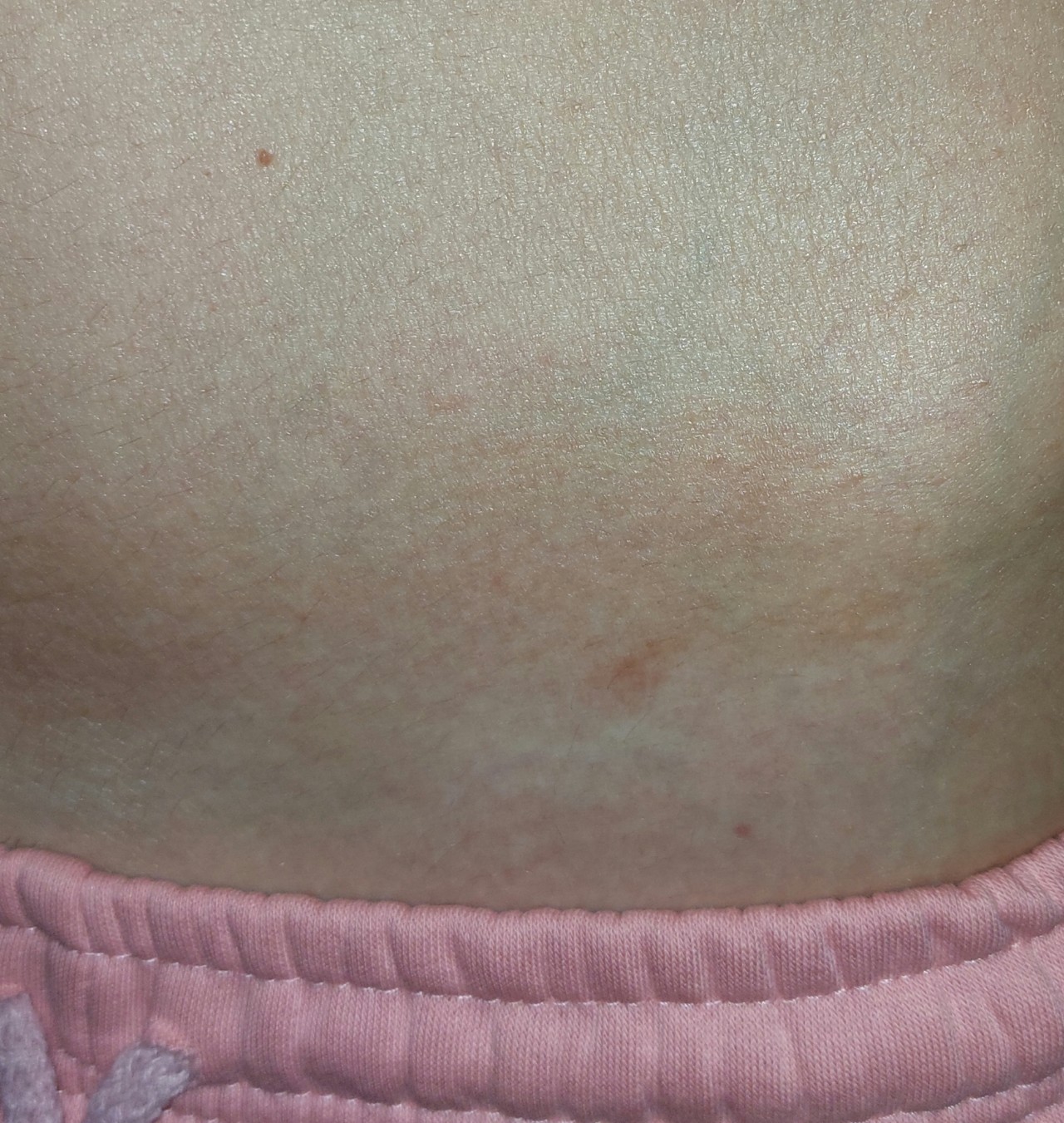 коричневые пятна на груди беременность фото 76