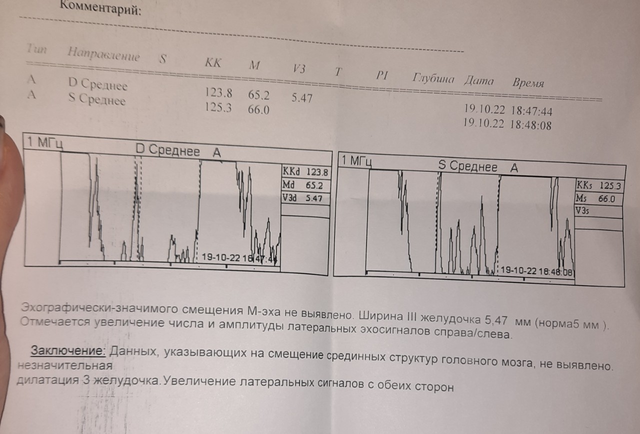 Расшифровка по фото