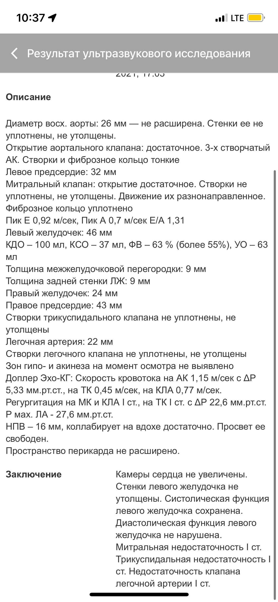 Недостаточность трикуспидального клапана степени