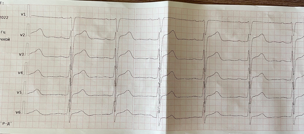 Прочитать экг по фото онлайн