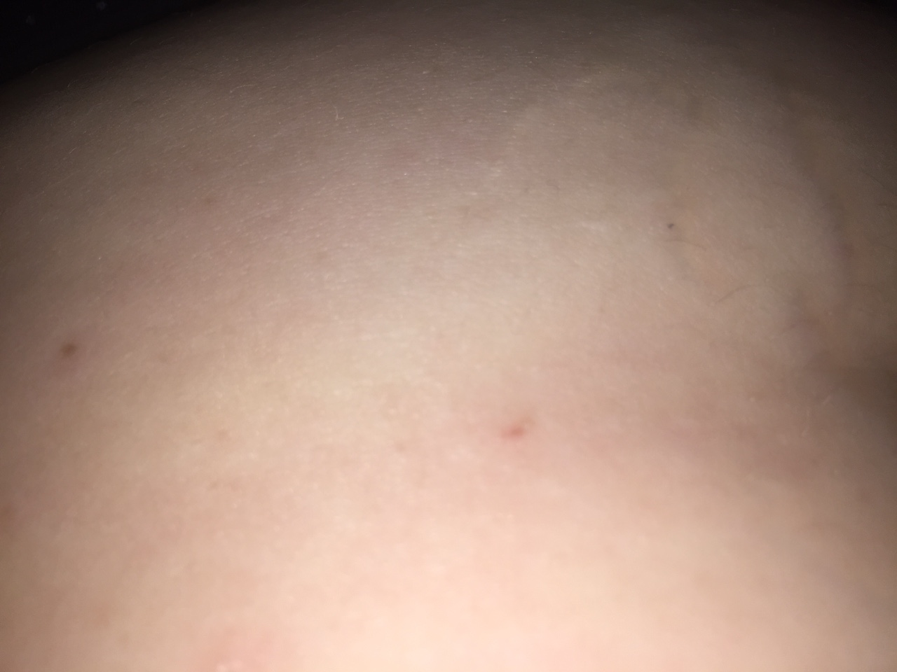 красные точки на груди беременность фото 80