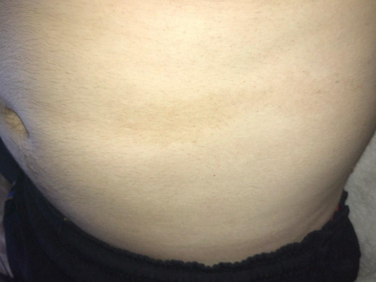 сыпь на груди животе при беременности фото 59