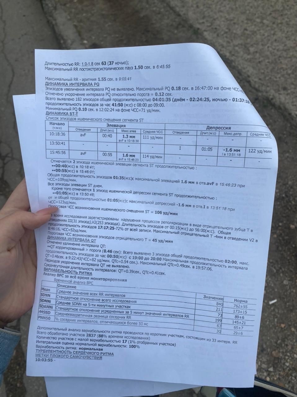 Заключение по холтеру - Вопрос кардиологу - 03 Онлайн