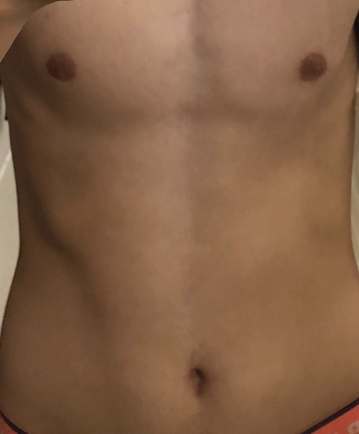 уплотнение под кожей в груди у мужчин фото 28