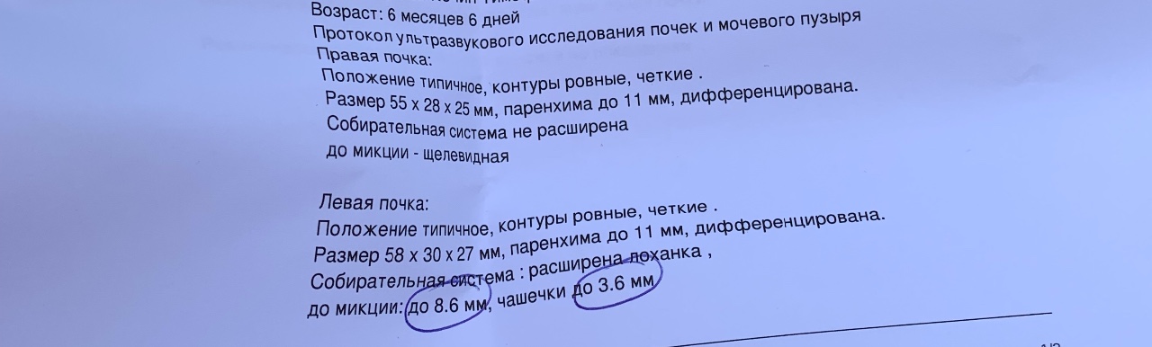 Лоханка на узи у ребенка. Размеры чашечек почек в норме. По УЗИ лоханка, чашечки в норме. Чашечки почек норма у взрослого. Норма по УЗИ лоханок и чашечек почек.