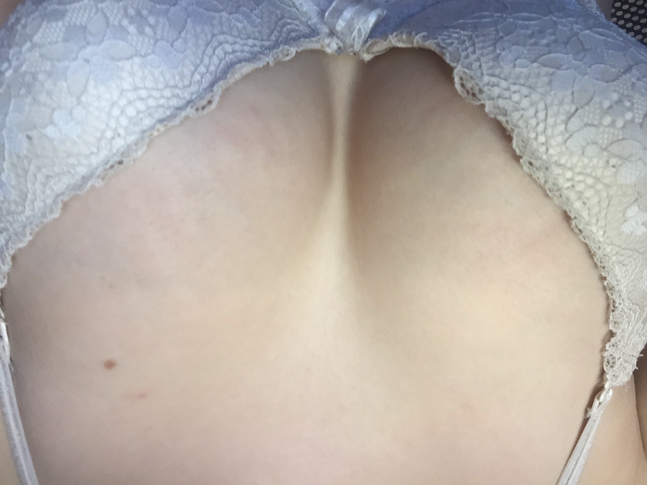 растяжки на груди во время беременности фото фото 115