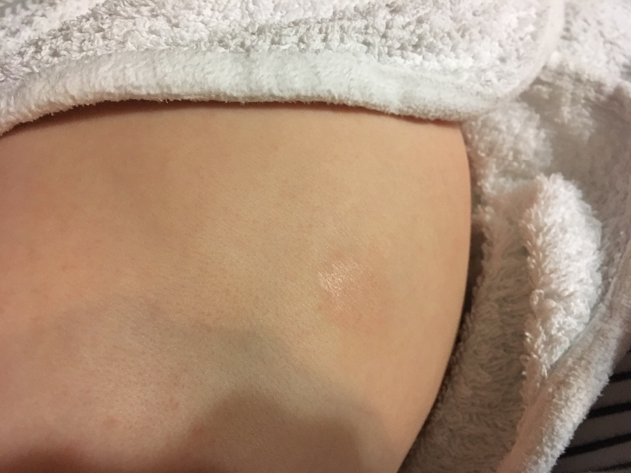 сухая кожа на груди при беременности фото 94