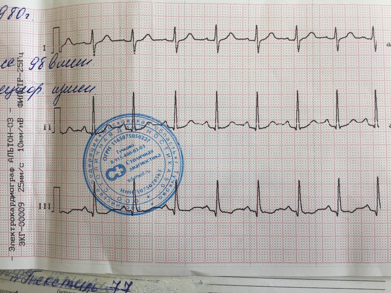 Нужна ли медицинская карта на экг