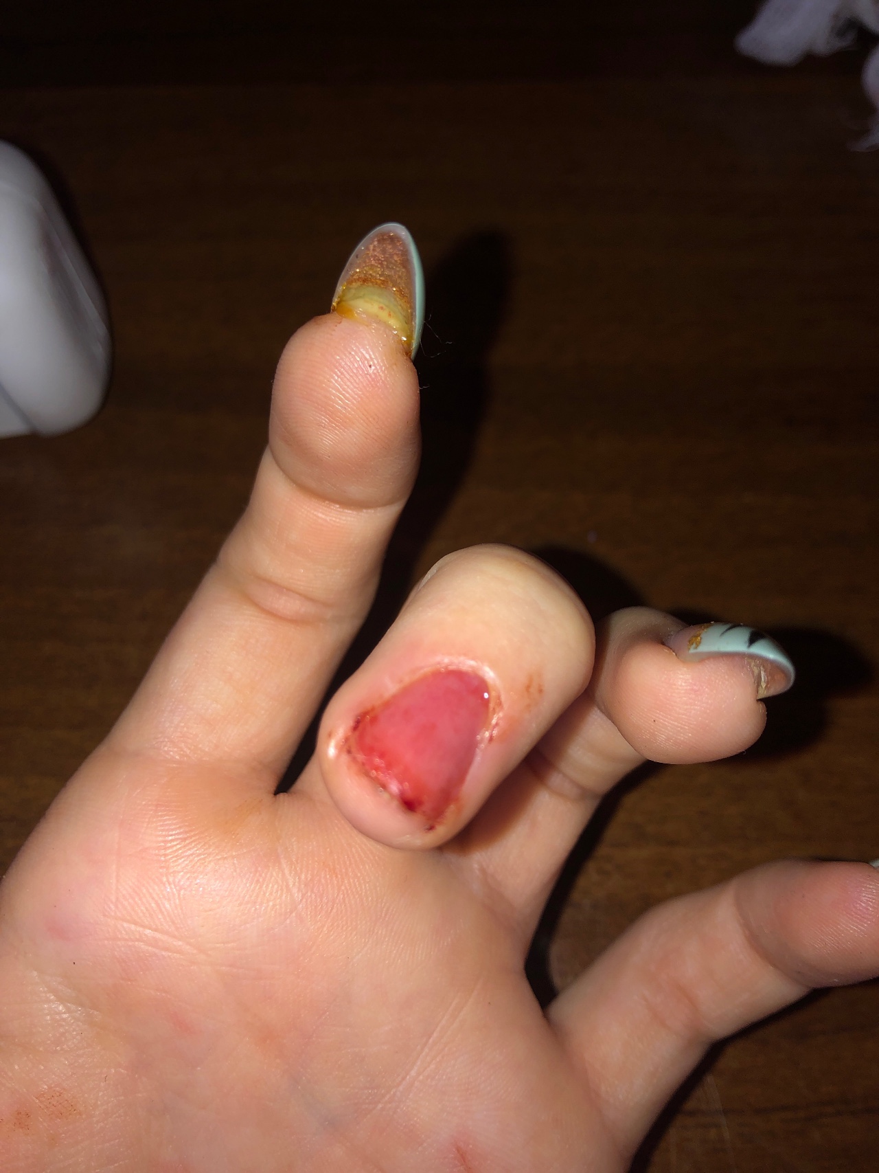 Виды повреждений ногтей