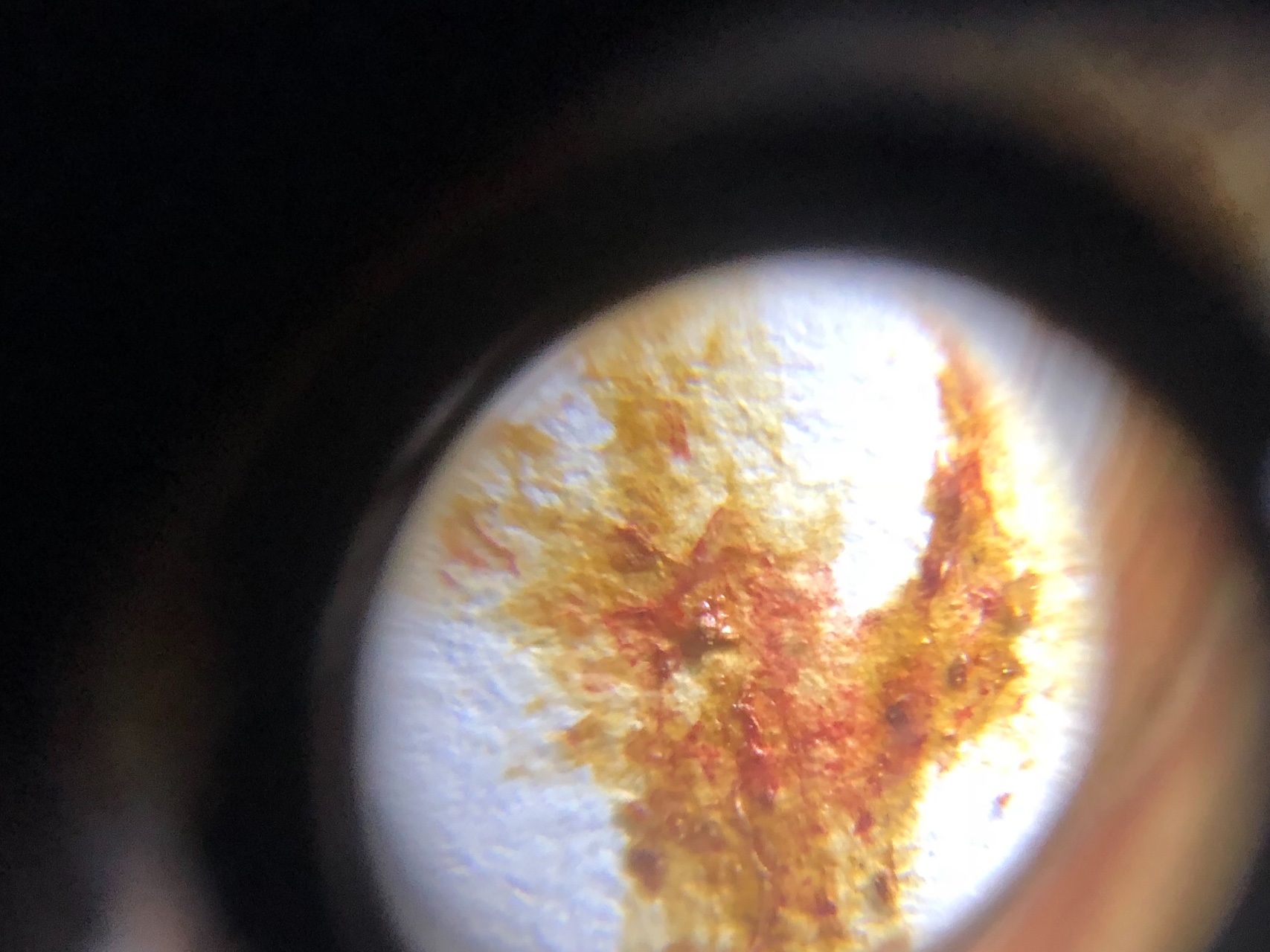 Пыльца в кале под микроскопом фото