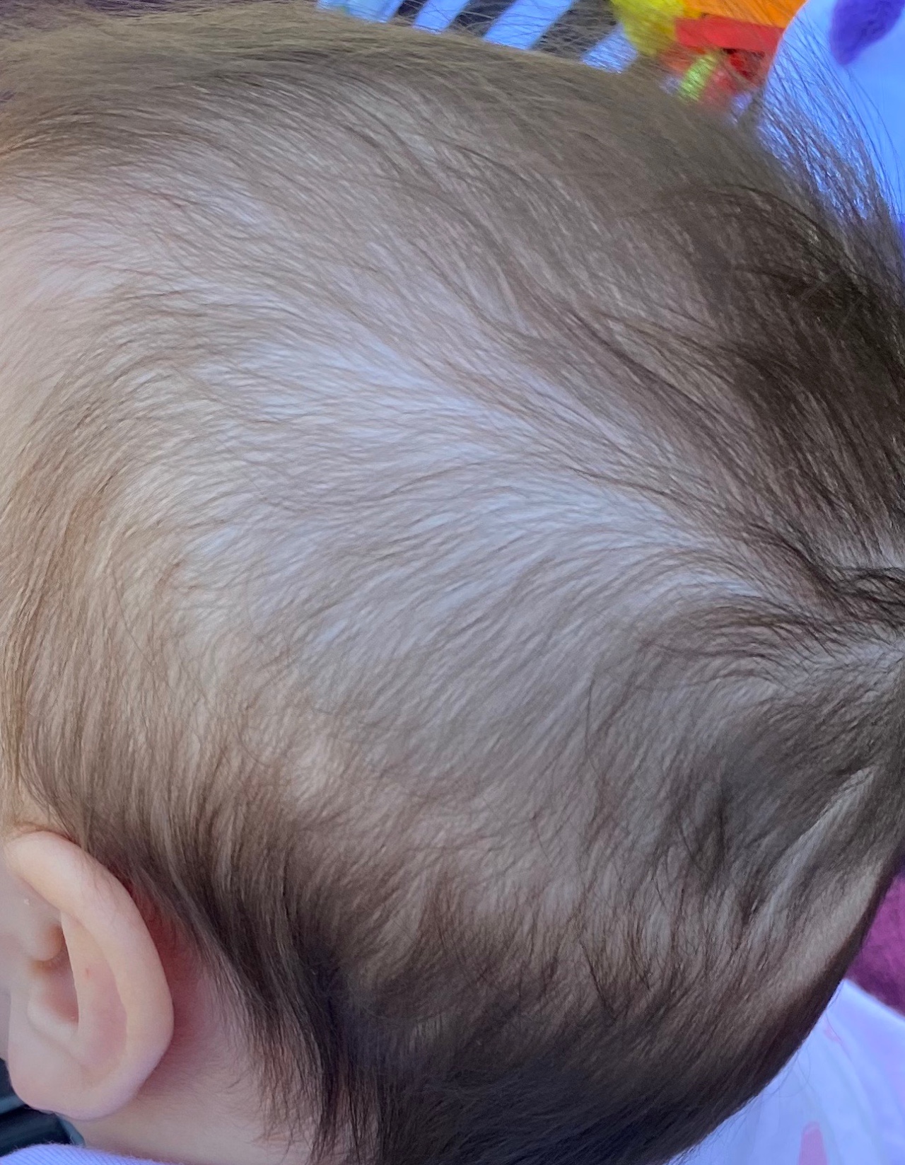 У ребенка на голове появилось пятно без волос что это такое
