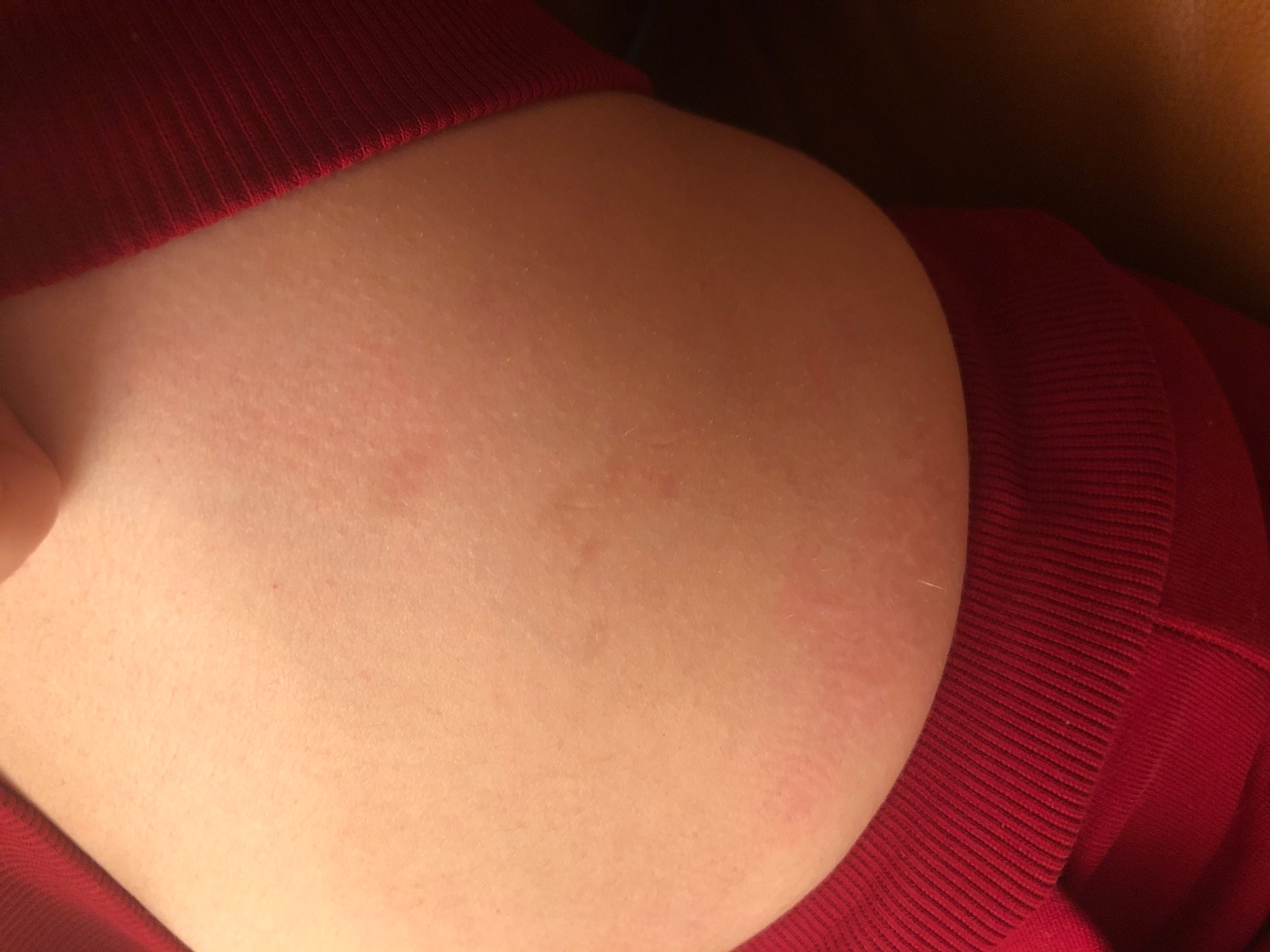появилось красное пятно на груди при беременности фото 106