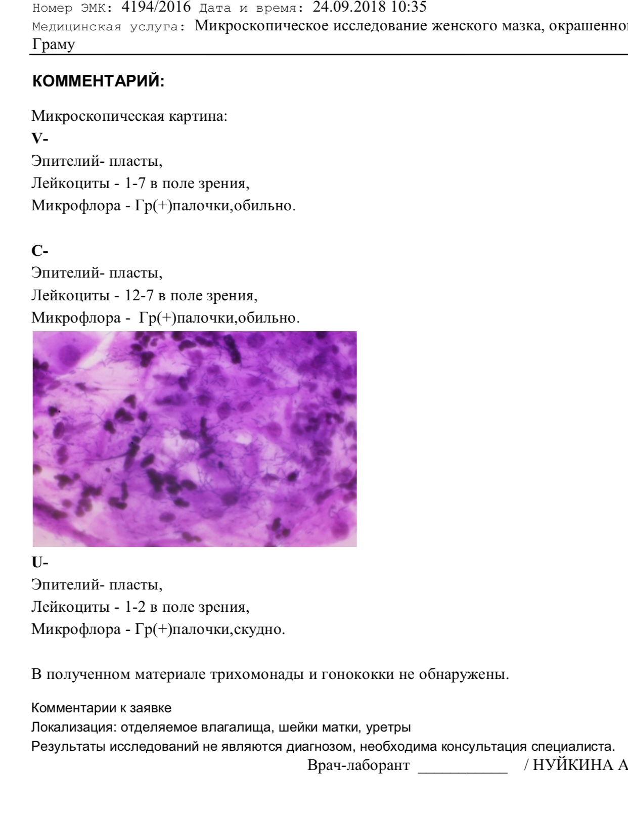 Цилиндрические клетки в мазке у женщин. Обзорный мазок женский микроскопия. Много эпителия в мазке на флору. Микроскопия женских мазков на флору в картинках с описанием. Результаты анализа микроскопическая картина мазка.