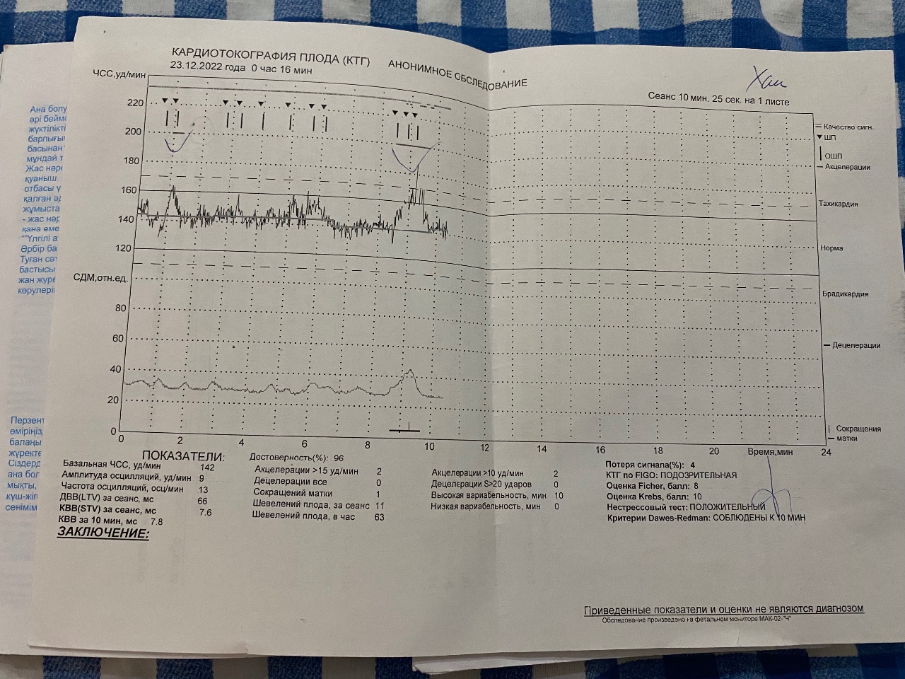Ктг при беременности баллы