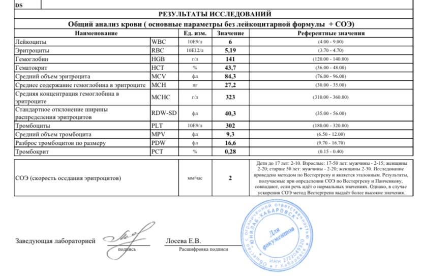 Минус вирус фотография