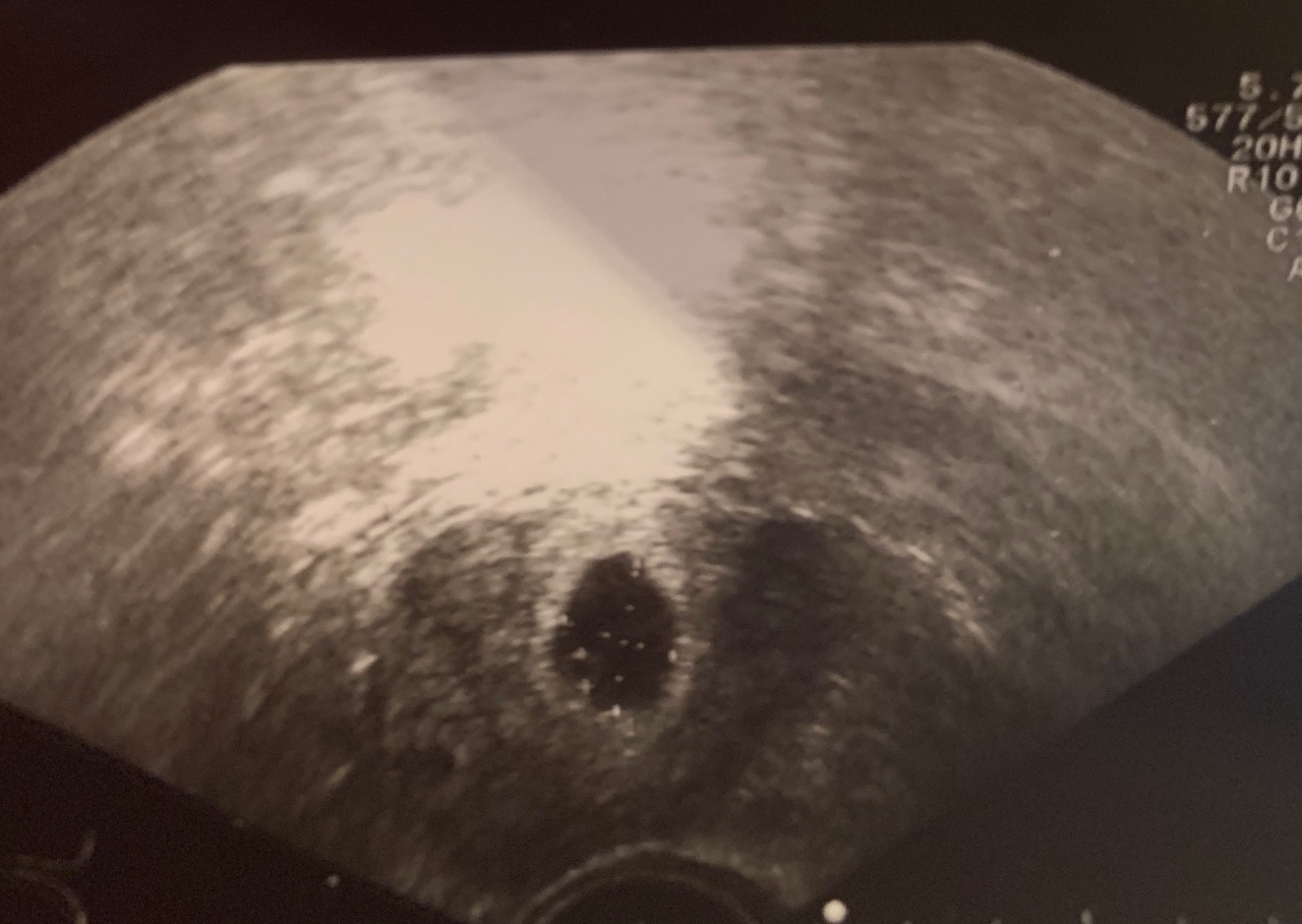 Трехдневный эмбрион фото