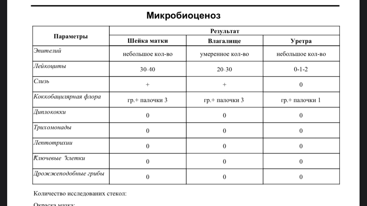 Коды флюорографии легких. Таблица расшифровки цифр флюорографии. Коды результатов флюорографии. Результаты флюорографии расшифровка. Шифр флюорографии.