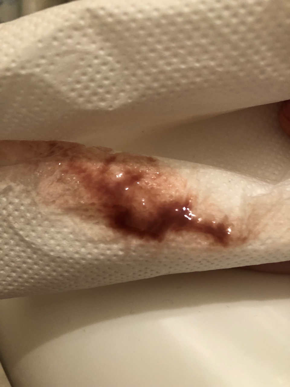 кровяные выделения во время оргазма фото 57