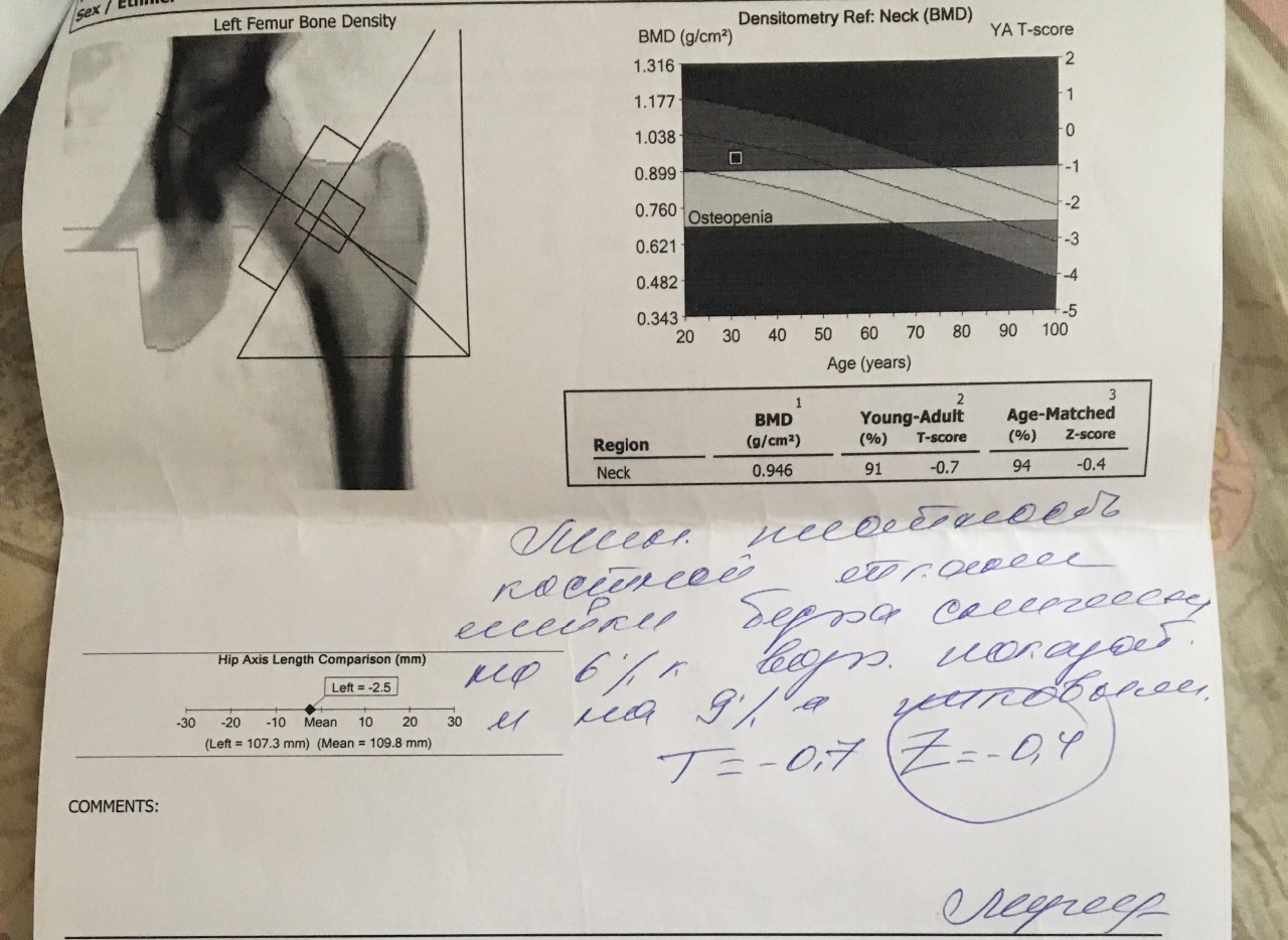 Денситометрия показатели. Остеоденситометрия остеопороз. Остеопороз денситометрия заключение. Денситометрия BMD норма. Денситометрия заключение.