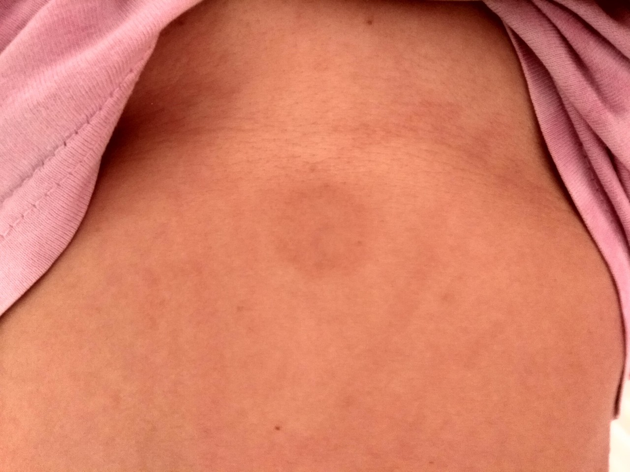 красные точки на груди у женщин фото 31