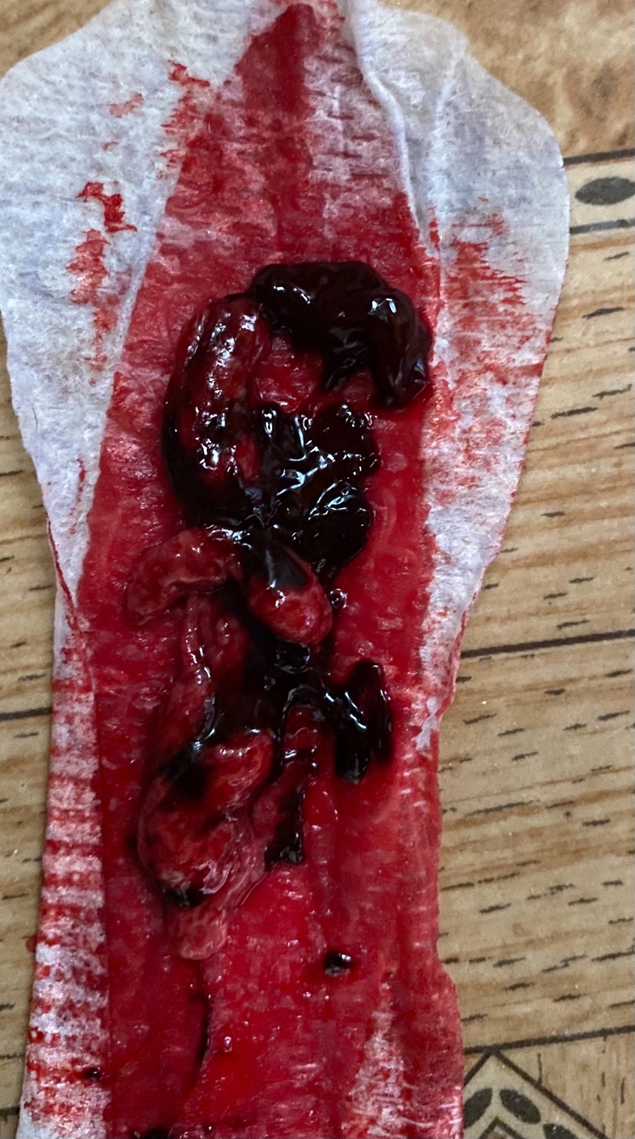 сгустки крови в сперме мужчин фото 38