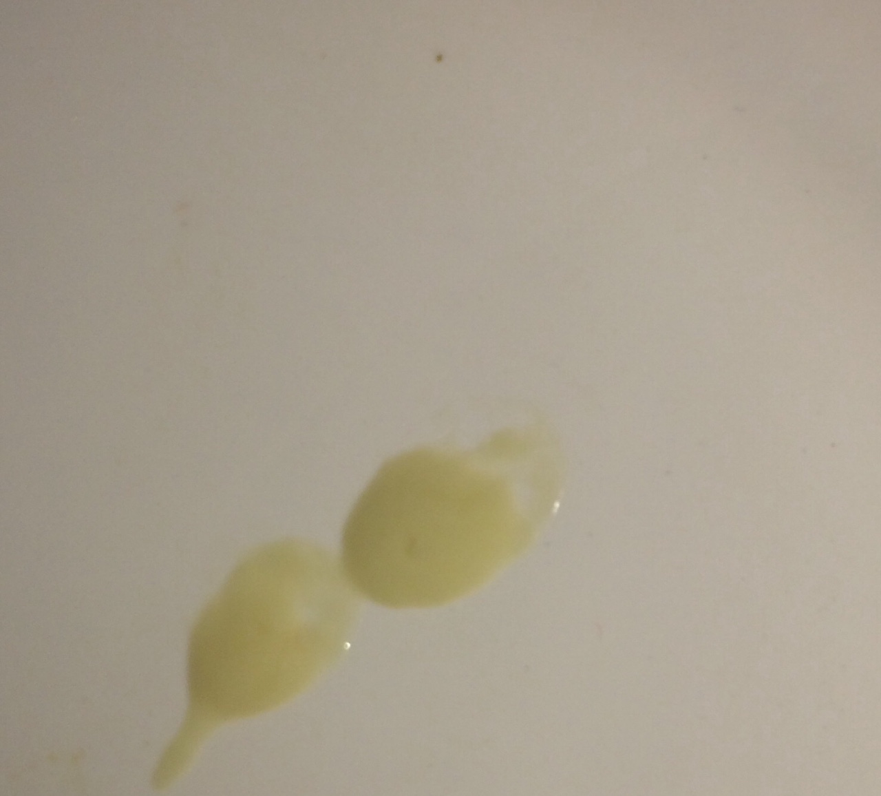 фурагин желтая сперма (120) фото